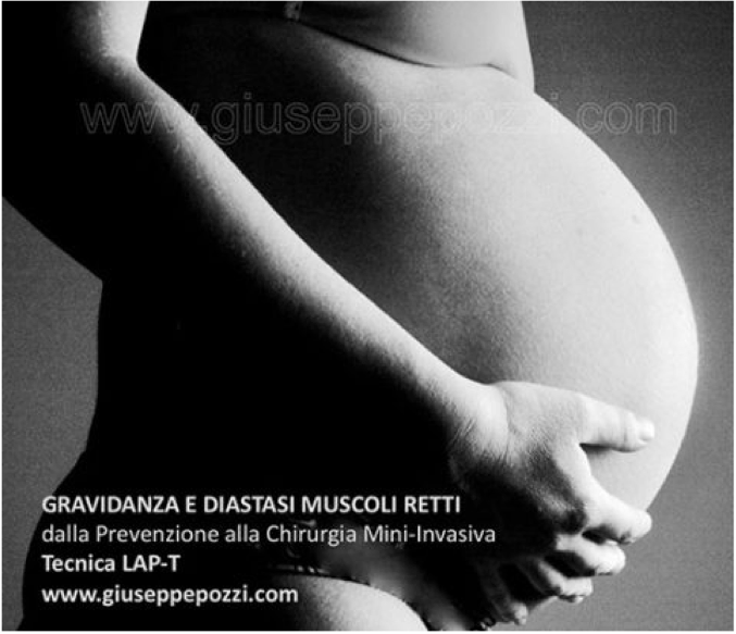 Articoli e news gravidanza
