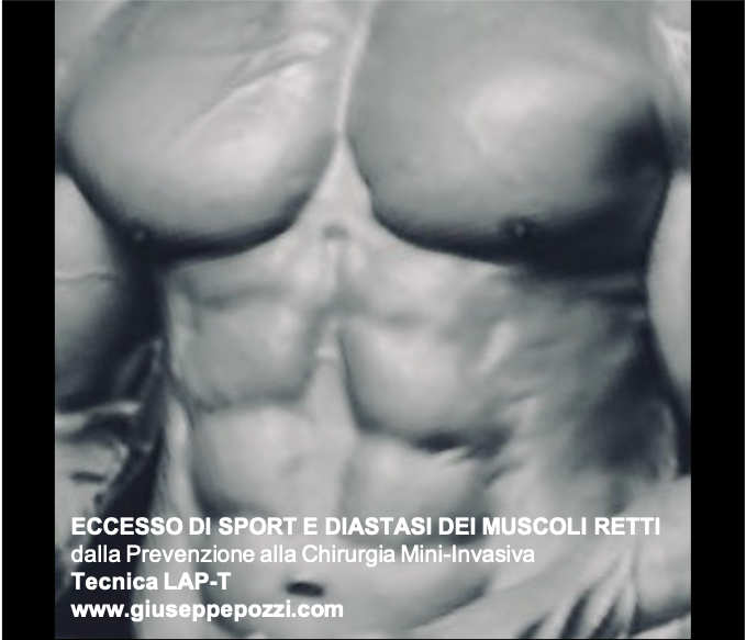 Articoli e news diastasi