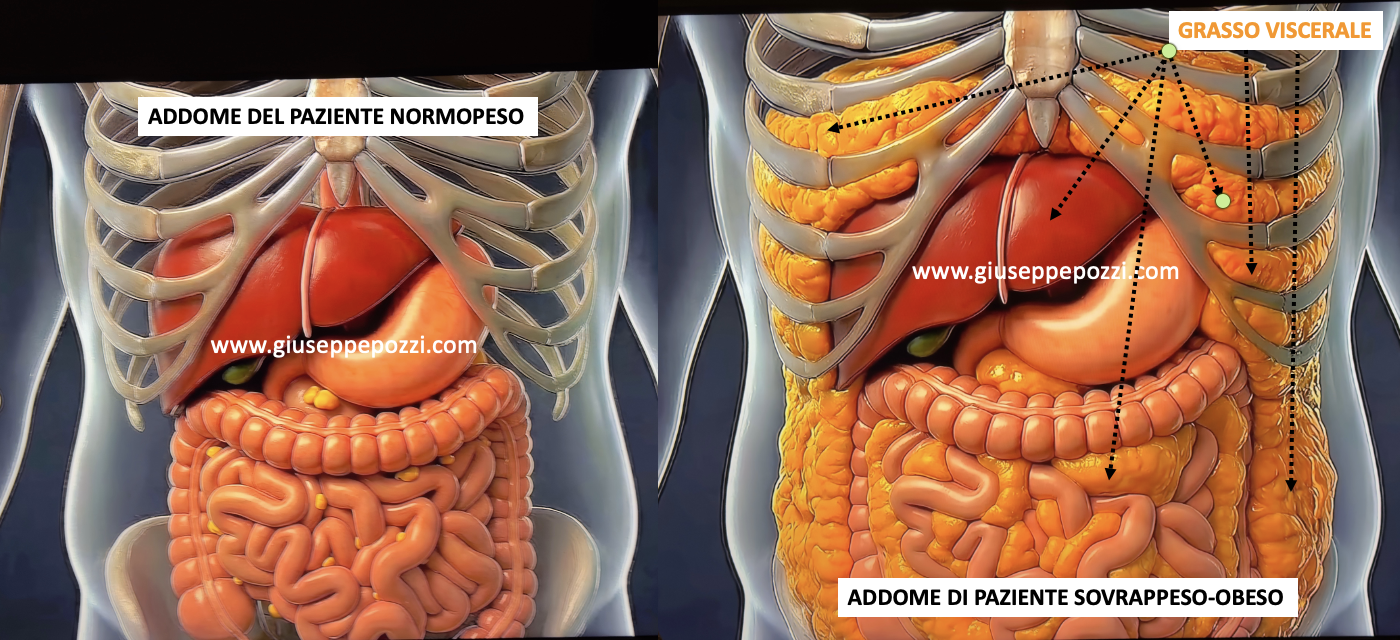 illustrazione confronto uomo normo peso e uomo sovrappeso