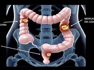 Chirurgia oncologica gallery 5
