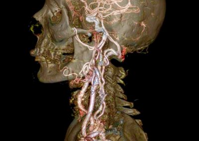 prevenzione oncologica