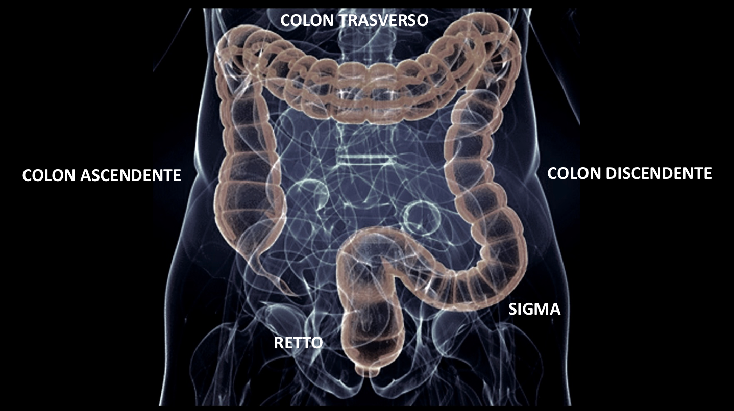 diverticoli del colon 