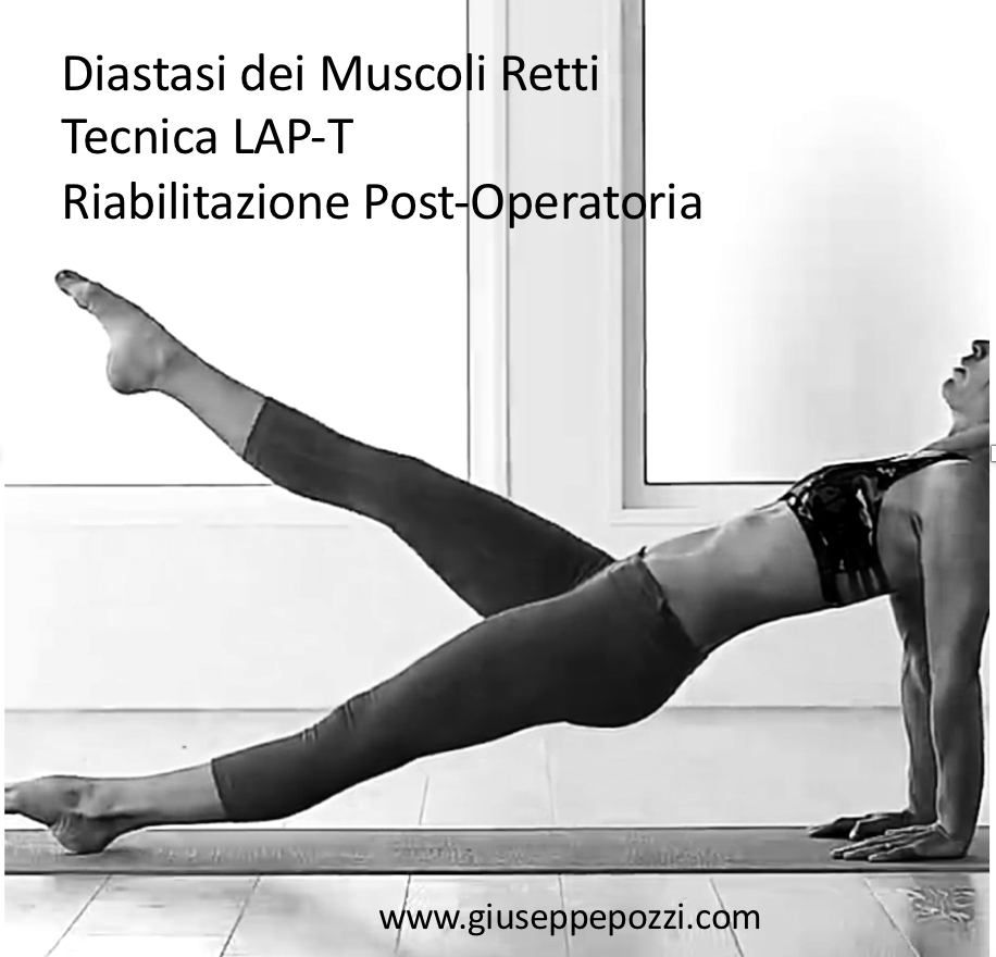 diastasi post operazione