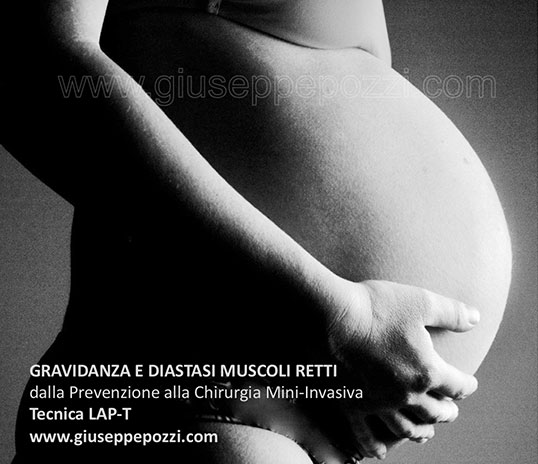 diastasi addominale cause gravidanza