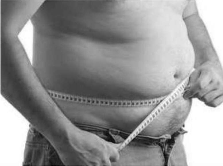 diastasi addominale obesità